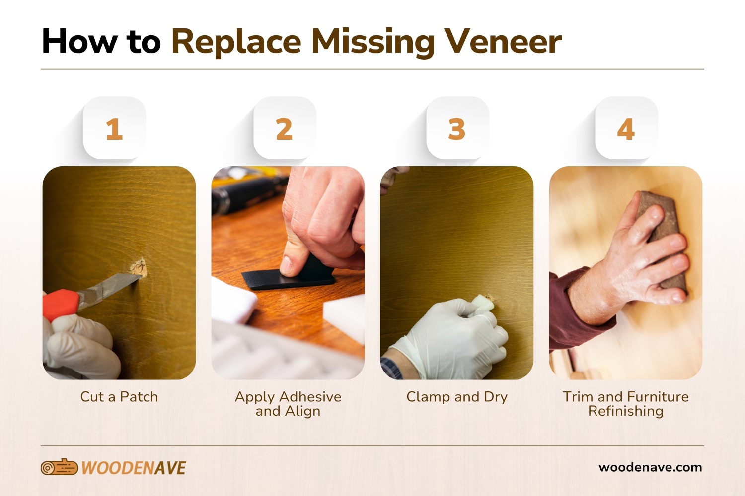 How to Replace Missing Veneer